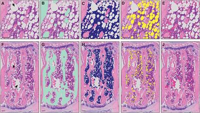 MarrowQuant Across Aging and Aplasia: A Digital Pathology Workflow for Quantification of Bone Marrow Compartments in Histological Sections